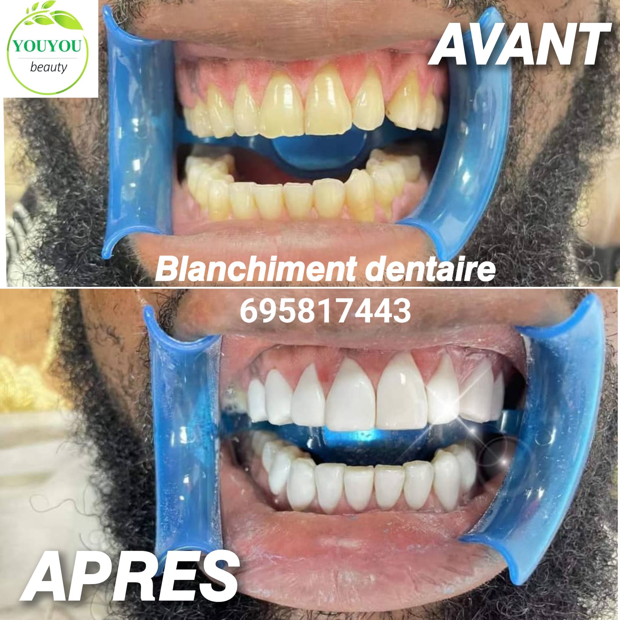 Youyou Services Images 4